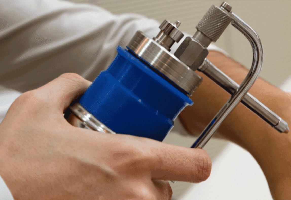 Crioterapia dermatologica