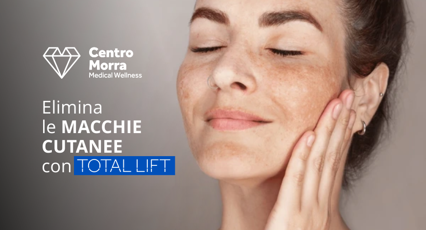 Total Lift | Il Ringiovanimento del volto senza Bisturi | Centro Morra Pomigliano