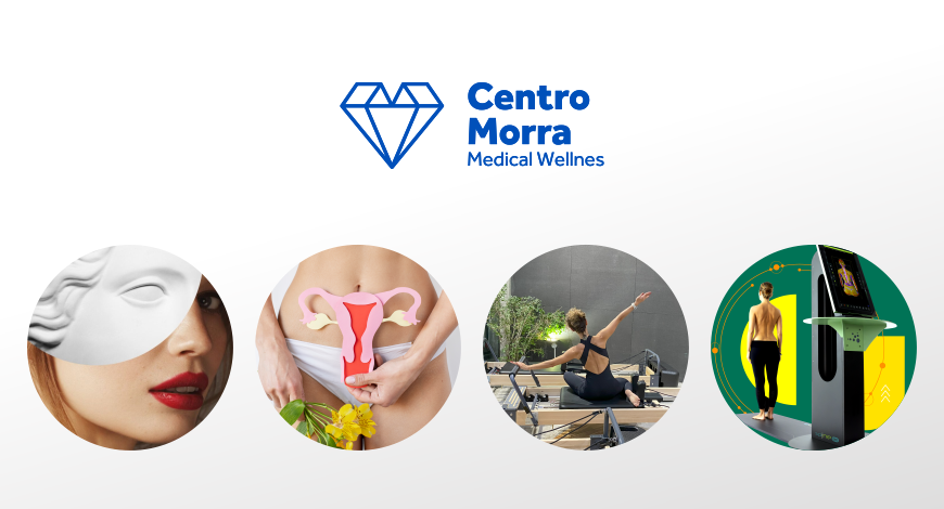 Centro Morra | Pomigliano