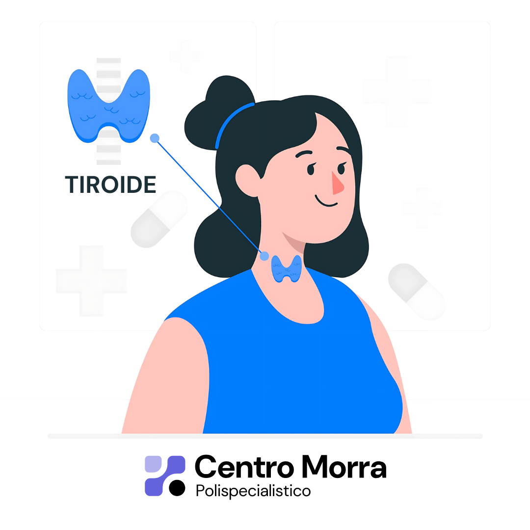 tiroide