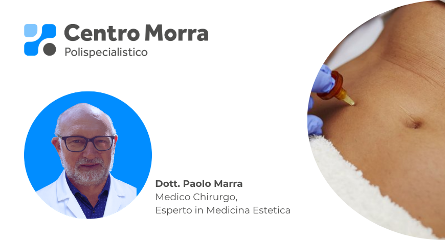 Open Day Medicina Estetica 2026 Carbossiterapia