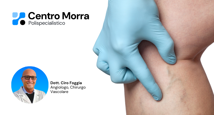 Angiologo pomigliano