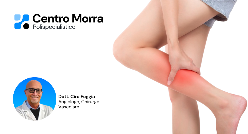 angiologo pomigliano