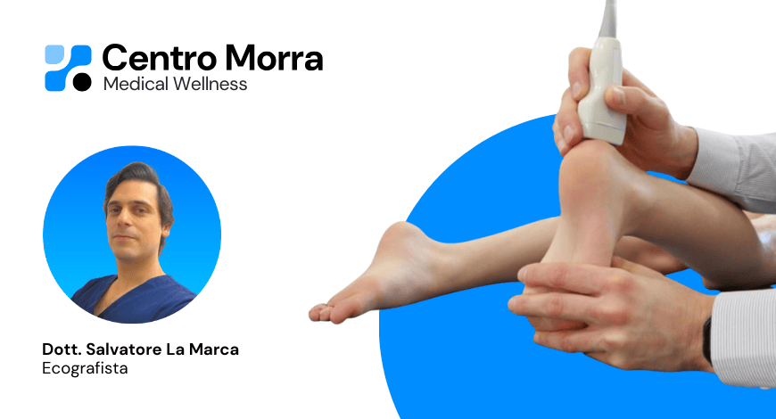 Dolore al tendine d’Achille: segnali da non sottovalutare e quando sottoporsi ad ecografia