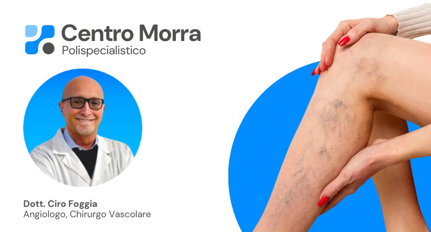 Il ruolo chiave della visita angiologica nella salute delle vene